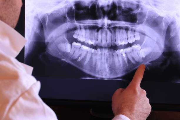 Best Emergency Tooth Extraction in Rib Mountain, WI