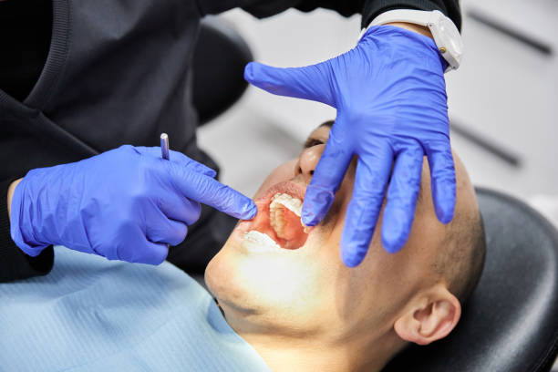 Best Emergency Dental Care for Broken or Chipped Teeth in Rib Mountain, WI