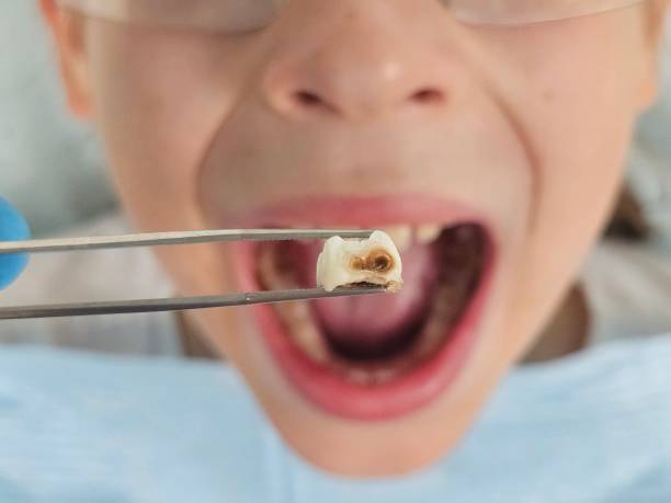 Best Emergency Denture Repair in Rib Mountain, WI